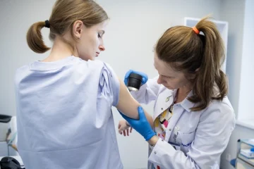 Де у Києві проводять безплатний огляд родимок до Дня меланоми