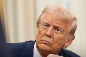 У Трампа виявили хронічну венозну недостатність. Він обстежувався через набряки й синці