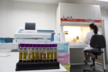 ООН пропонує закрити UNAIDS у 2026 році через скорочення фінансування