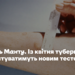 Замість Манту. З квітня туберкульоз діагностуватимуть новим тестом