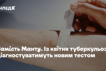 Замість Манту. З квітня туберкульоз діагностуватимуть новим тестом