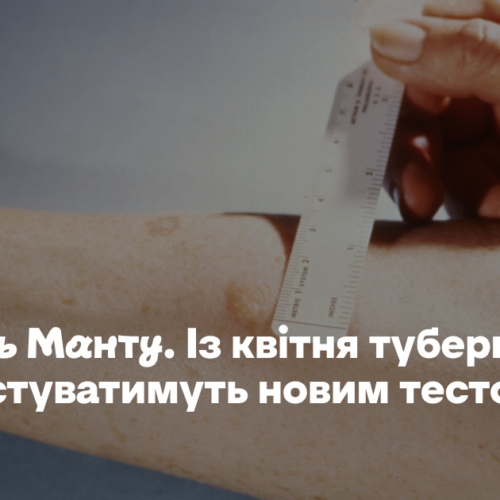 Замість Манту. З квітня туберкульоз діагностуватимуть новим тестом