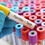 Весна настала, а настрій не поліпшився? Чому це може бути дефіцит заліза